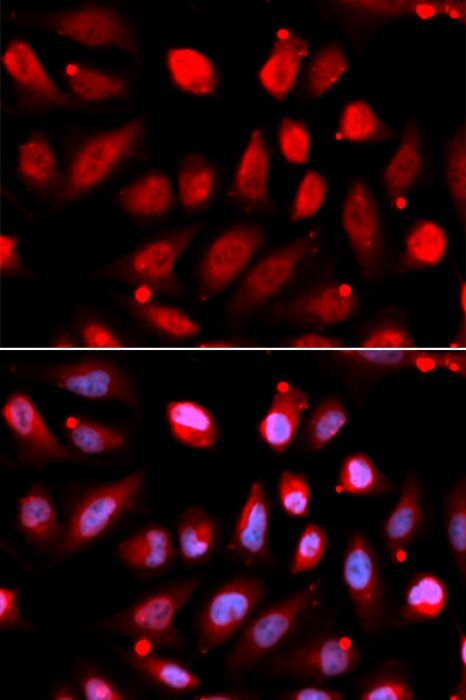 Immunohistochemistry - EZH2 Polyclonal Antibody (144-011085)