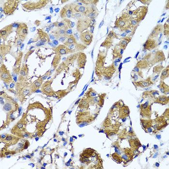 Immunohistochemistry - HYAL1 antibody (144-06623)