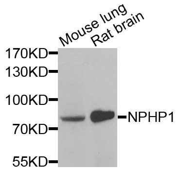 Western blot - NPHP1 Polyclonal Antibody (144-06674)
