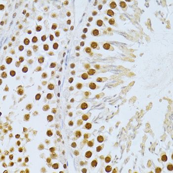 Immunohistochemistry - SIRT1 Polyclonal Antibody (144-011267)