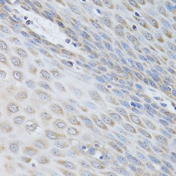 Immunohistochemistry - IKBKG Polyclonal Antibody (144-00917)