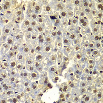 Immunohistochemistry - SSX5 antibody (144-07732)