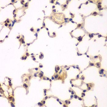 Immunohistochemistry - NFKBIB antibody (144-05777)