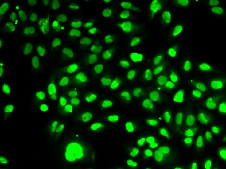 Immunofluorescence - NAMPT Polyclonal Antibody (144-00256)