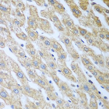 Western blot - [KO Validated] Eif2ak2 Polyclonal Antibody (144-05578)