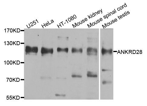 Western blot - ANKRD28 antibody (144-08365)