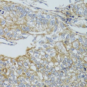 Immunohistochemistry - CHMP4B antibody (144-07402)