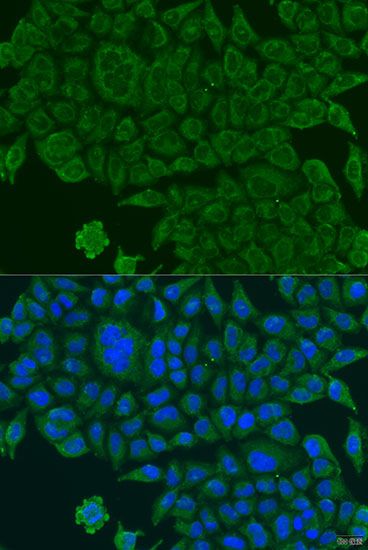 Immunofluorescence - BCS1L antibody (144-07647)