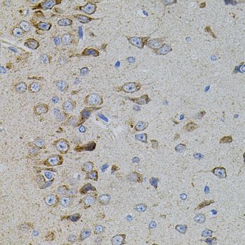 Immunohistochemistry - MAPK11 antibody (144-07717)