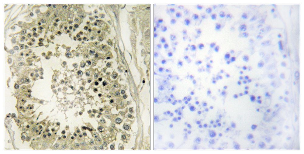 IHC
