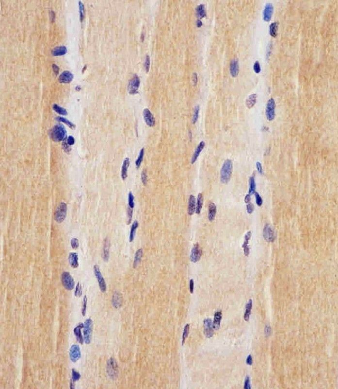 IHC-P