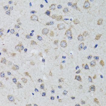 Immunohistochemistry - HTR3A antibody (144-05647)