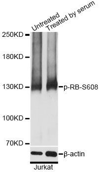 Western blot - Phospho-RB1-S608 pAb (144-61505)