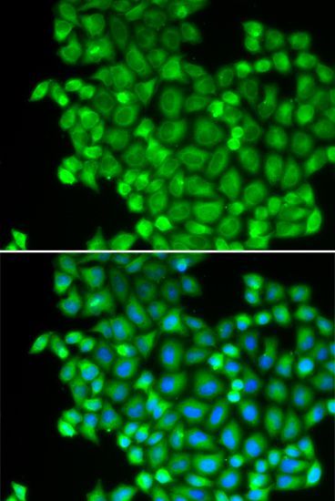 Immunofluorescence - LDHA Polyclonal Antibody (144-01146)