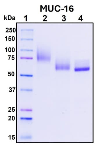 SDS-PAGE Image