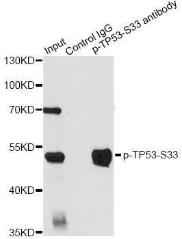 Immunohistochemistry - Phospho-TP53-S33 pAb (144-61510)