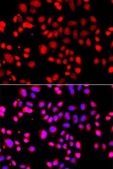 Immunofluorescence - ASPSCR1 Polyclonal Antibody (144-07481)
