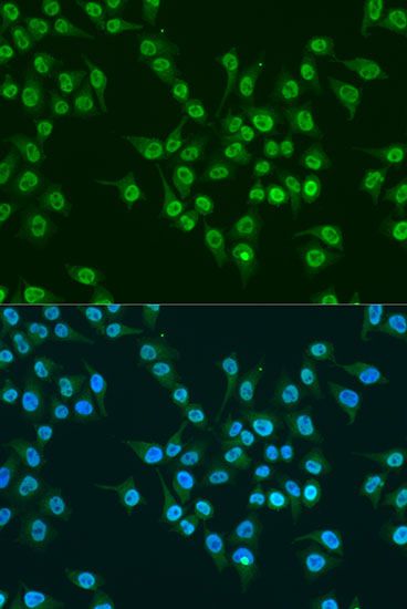 Immunofluorescence - KLF4 antibody (144-06640)