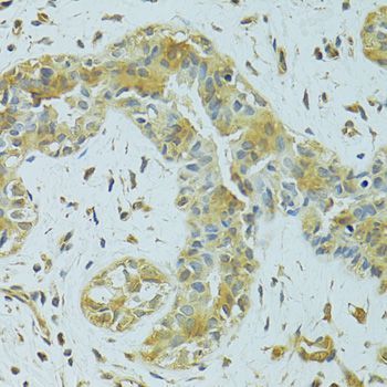 Immunohistochemistry - MTCH1 Polyclonal Antibody (144-08063)