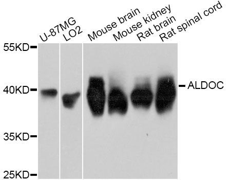 Western blot - ALDOC Antibody (144-11618)