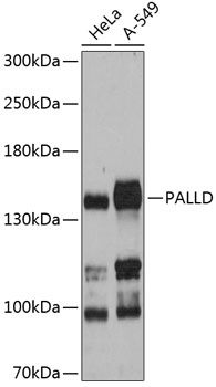 Western blot