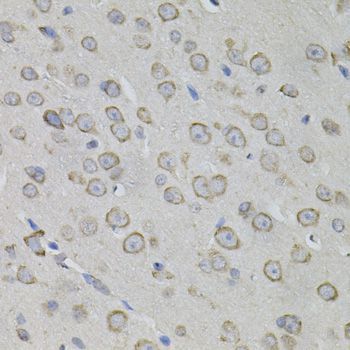 Immunohistochemistry - MYO10 antibody (144-012471)