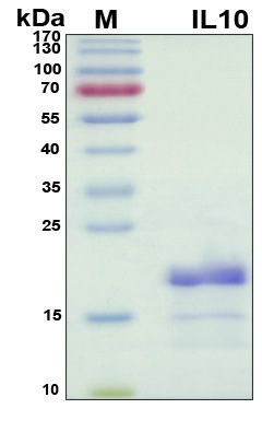 SDS-PAGE