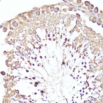 Immunohistochemistry - MME antibody (144-05664)