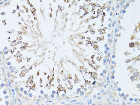 Immunohistochemistry - TEFM Polyclonal Antibody (144-08511)