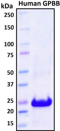 SDS-PAGE