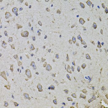 Immunohistochemistry - ARHGEF3 antibody (144-08490)