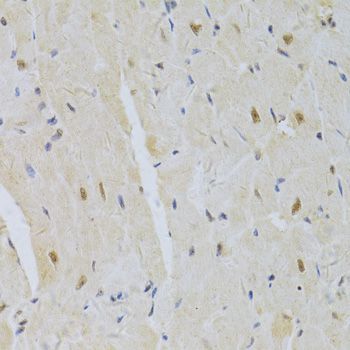 Immunohistochemistry - SNRPA Antibody (144-06410)