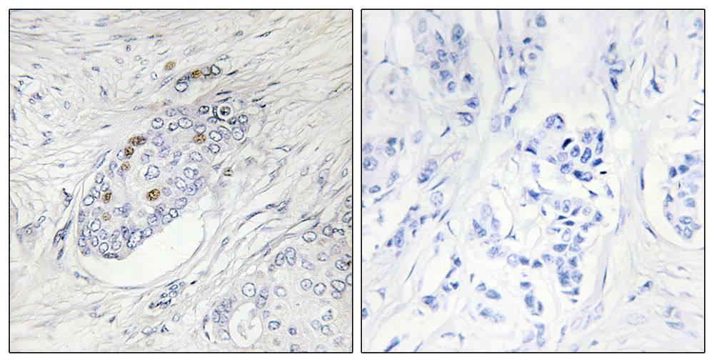 IHC