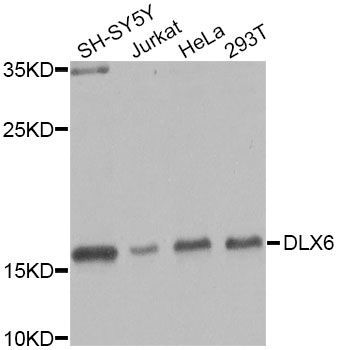 Western blot - DLX6 Antibody (144-07667)