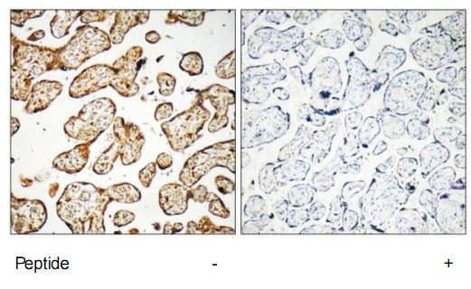 IHC