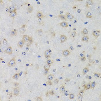 Immunohistochemistry - ISG15 Antibody (144-01182)