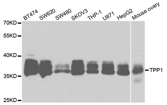 Western blot - TPP1 Polyclonal Antibody (144-05627)