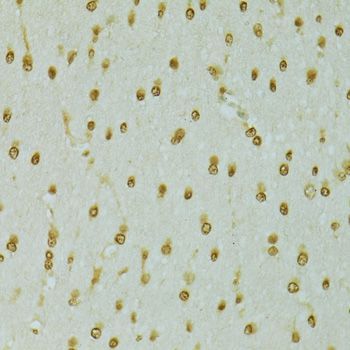 Immunohistochemistry - RCC1 Polyclonal Antibody (144-06350)