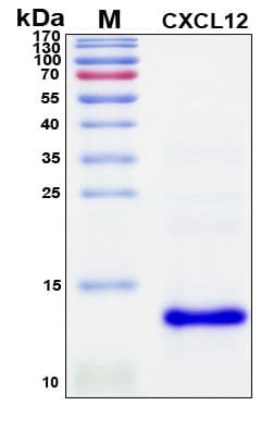 SDS-PAGE Image