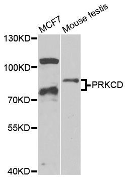 Western blot - PRKCD Polyclonal Antibody (144-00471)