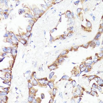 Immunohistochemistry - [KO Validated] ErbB2 Polyclonal Antibody (144-02071)