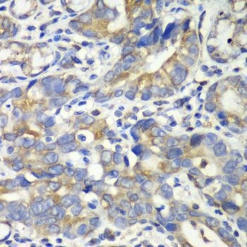 Immunohistochemistry - ABAT antibody (144-05299)