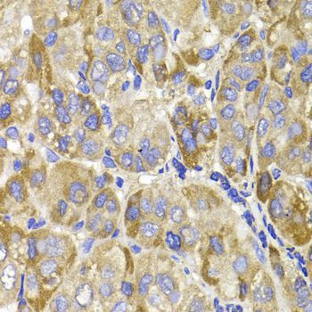 Immunohistochemistry - MAGED1 antibody (144-01092)