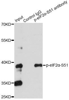 Immunoprecipitation - Phospho-eIF2?-S51 pAb (144-61508)