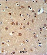 IHC-P