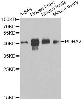 Western blot - PDHA2 antibody (144-09943)