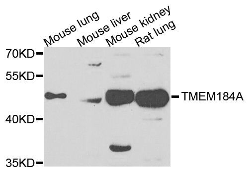 Western blot - TMEM184A antibody (144-07857)