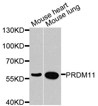Western blot - PRDM11 antibody (144-08502)