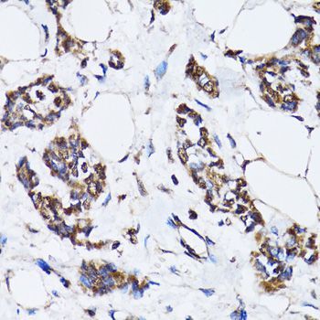 Immunohistochemistry - TP53 Polyclonal Antibody (144-05761)