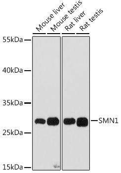 Western blot